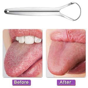 Tongue Scraper