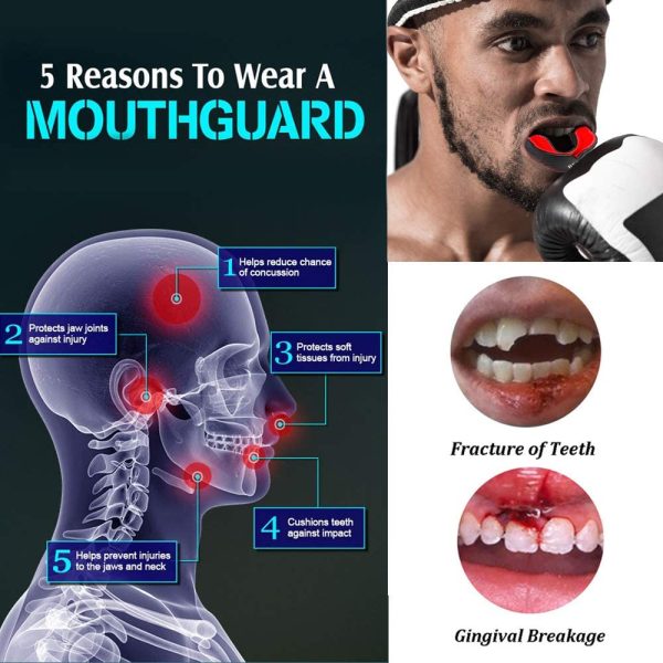 Gum Shield, Mouth Guard Boxing, Junior And Adult Mouthguard For Rugby Hockey Boxing Football Mma Sports, Kids Mouldable Gumshield For Muay Thai, Martial Arts, Bjj - Image 5