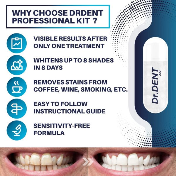 DrDent Professional LED Teeth Whitening Kit - Sensitivity Free Formula - 8 Teeth Whitening Gel Pods 33.6ml - Helps to Remove Stains - Includes Mouth Tray & Shade Guide - Rapid & Effective Results