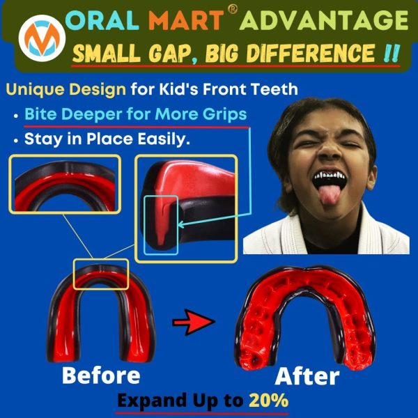 Oral Mart Sports Gum Shield for Kids/Adults (UK Flag & Vampire Fangs & 15 Best Colors) - for Rugby, Boxing, MMA, Martial Arts, Judo, Karate, Hockey, BJJ - Image 5