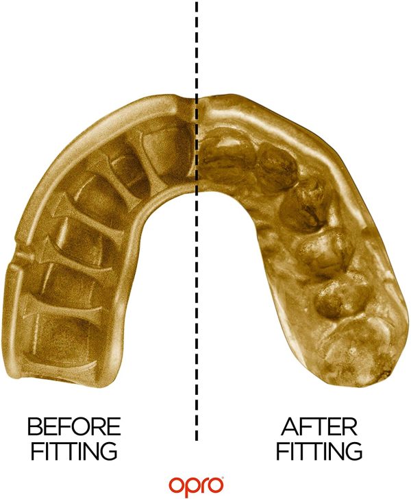 OPRO Gold Level Custom Fit Mouthguard - Image 4