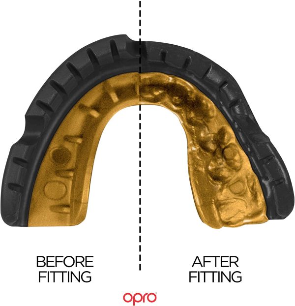 Opro Gold Level Mouthguard for Braces | Gum Shield for Rugby, Hockey and other Contact Sports - Image 6