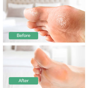 nourish foot peel mask